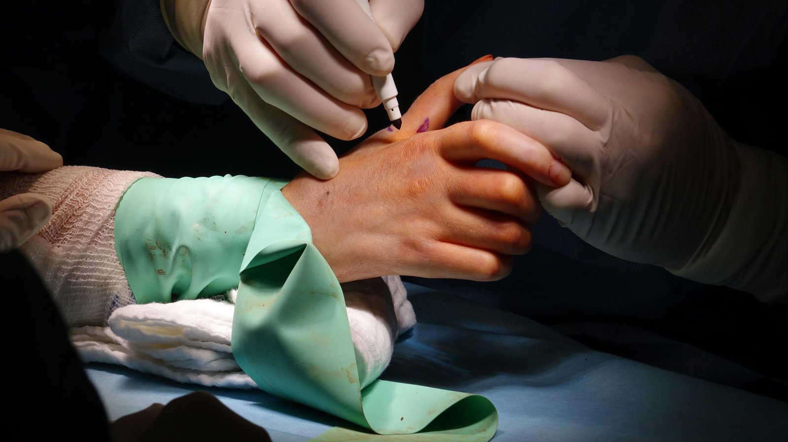 Deformities of Ear, Hands, Feet