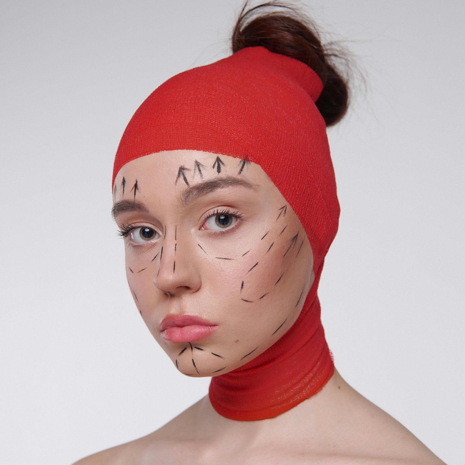 Rhinoplasty Nose Surgery