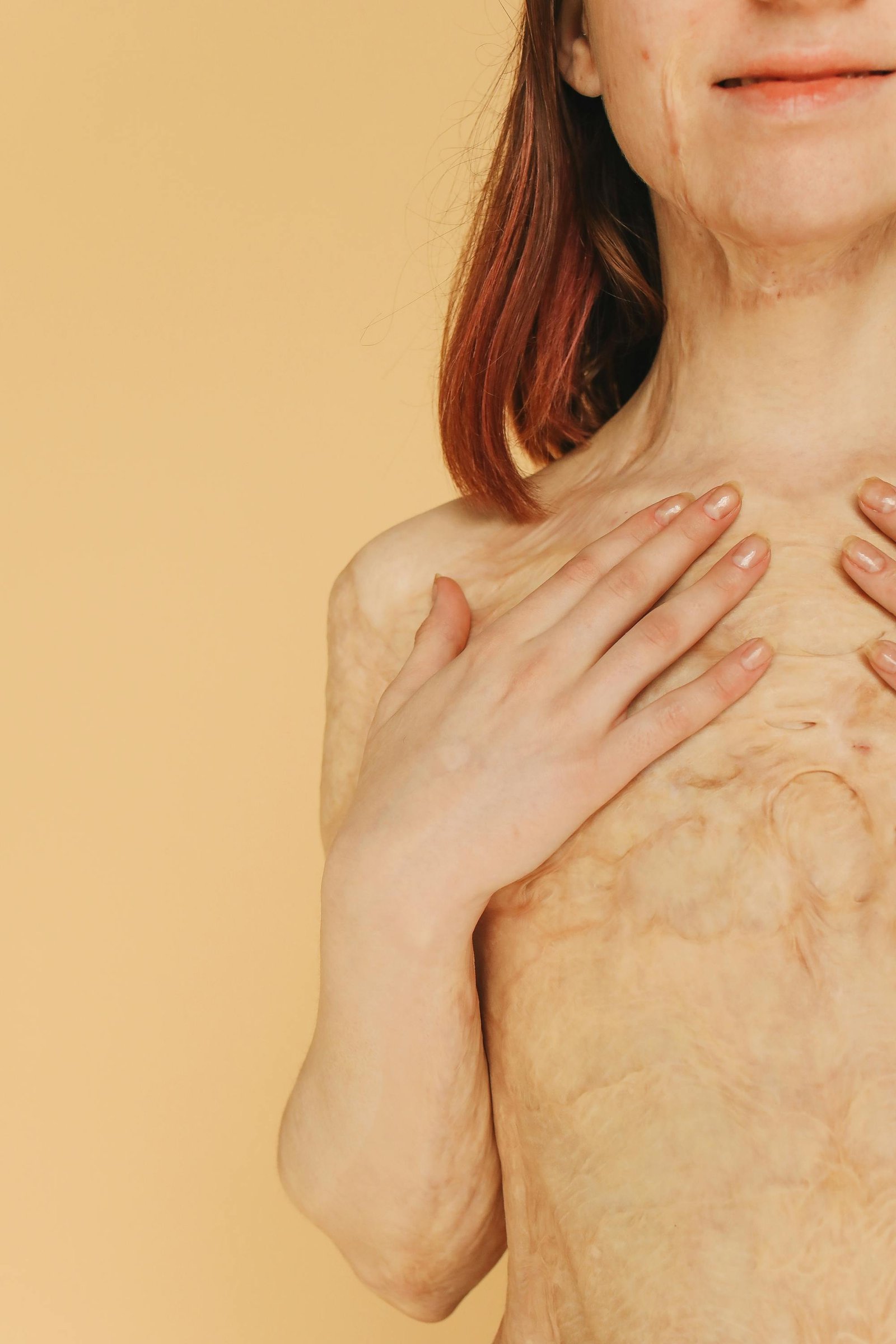 Accident Reconstructive Surgery